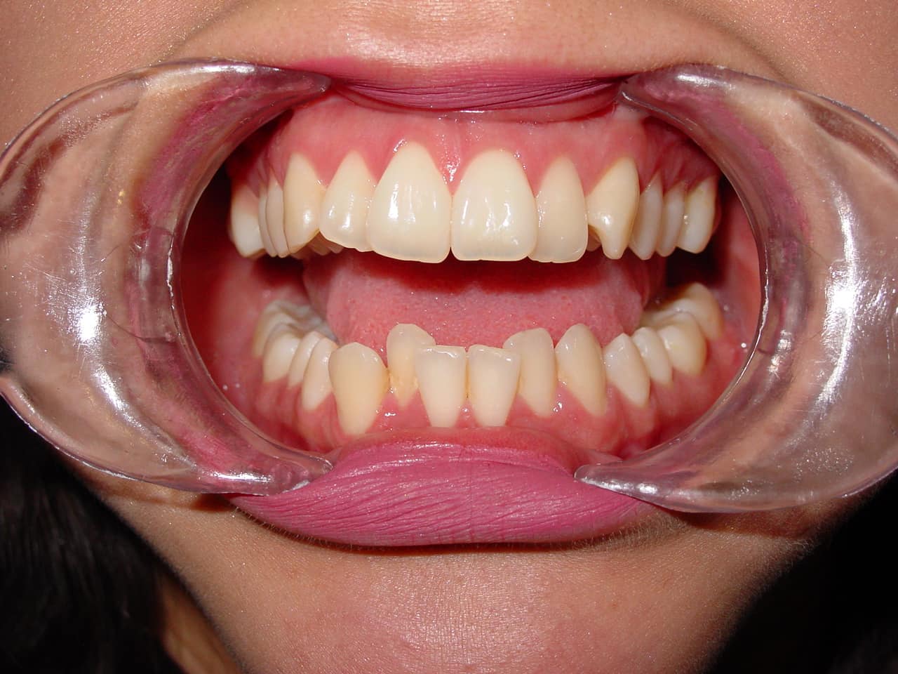 Caso de éxito B-ORTHODONTICS